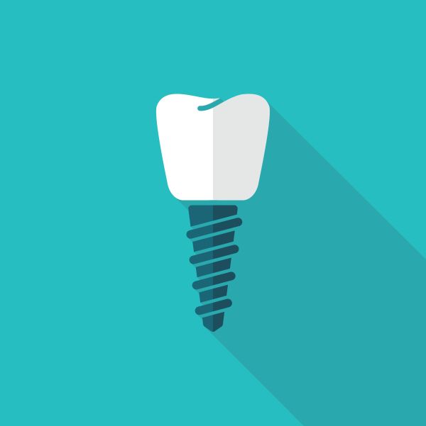 Situations To Consider Getting Dental Implants